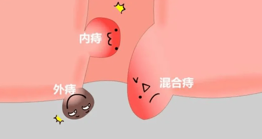 ̯@ʲô@ôʹ(dng)Ѫ˨
